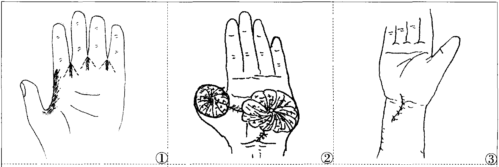 皮肤及附属组织